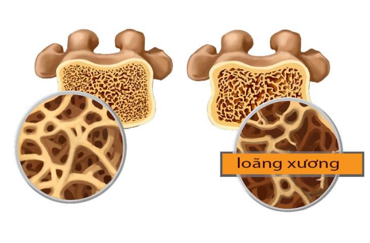 13 lợi ích sức khỏe từ hạt dưa, món ăn vặt ngày Tết- Ảnh 4. 13 lợi ích sức khỏe từ hạt dưa, món ăn vặt ngày Tết- Ảnh 4.