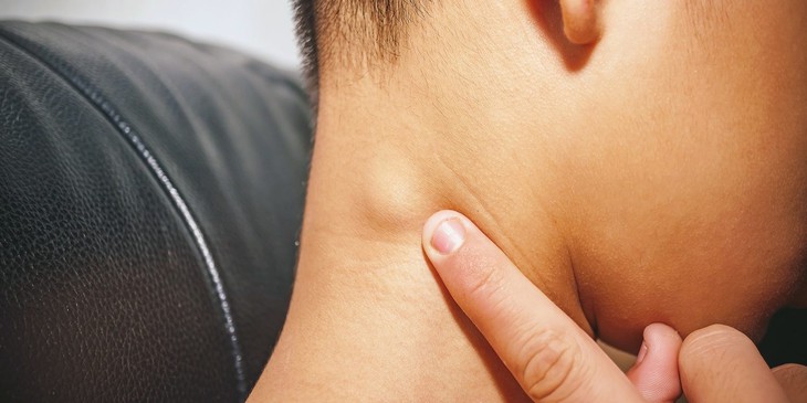 Trẻ nổi hạch có đáng lo, khi nào cần nhập viện?- Ảnh 1.