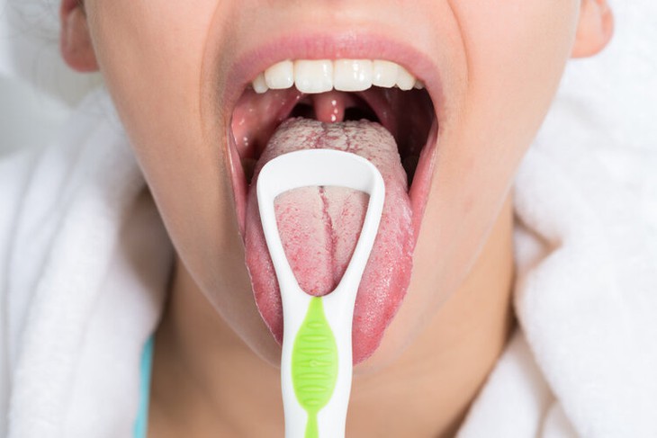 Ung thư lưỡi phát triển đến giai đoạn cuối ảnh hưởng lớn đến sức khỏe, tính mạng người bệnh.