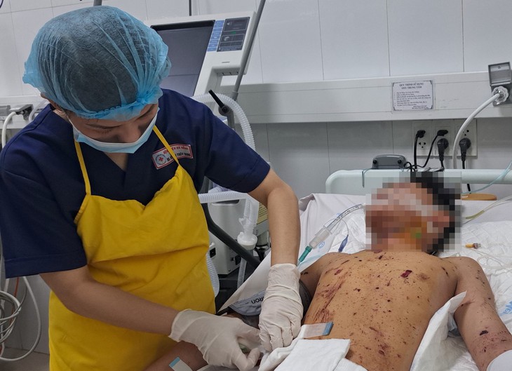 Thủng bụng, lộ nội tạng chỉ vì pháo- Ảnh 1.