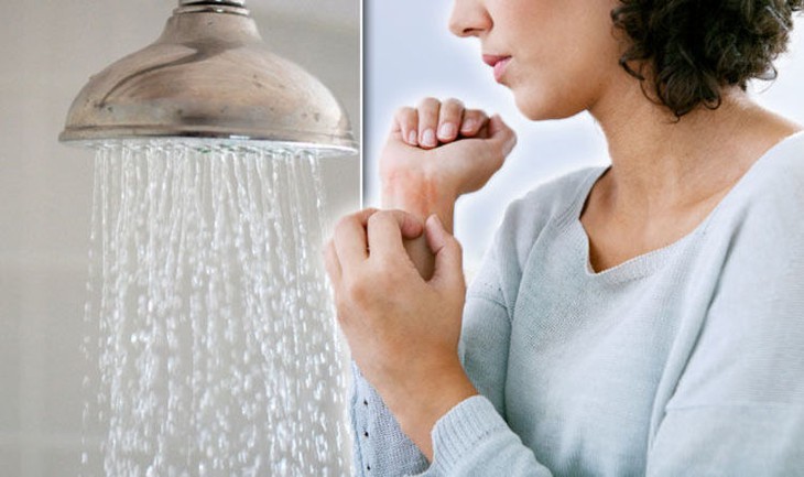 Lợi ích và rủi ro khi tắm nước nóng- Ảnh 5.