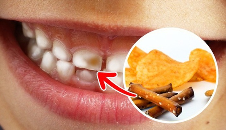 5 nhóm thực phẩm bạn nên ăn để răng chắc khỏe- Ảnh 1. 5 nhóm thực phẩm bạn nên ăn để răng chắc khỏe- Ảnh 1.