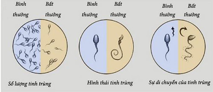 Nam giới nên thận trọng với 4 loại thực phẩm gây hại cho tinh trùng- Ảnh 1. Nam giới nên thận trọng với 4 loại thực phẩm gây hại cho tinh trùng- Ảnh 1.