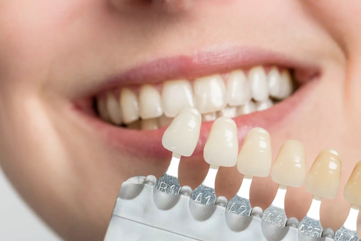 Mòn răng: Nguyên nhân, triệu chứng, cách điều trị và phòng bệnh- Ảnh 4.