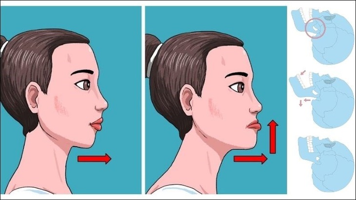 Tập luyện giúp phòng ngừa, hỗ trợ điều trị mòn răng- Ảnh 6.