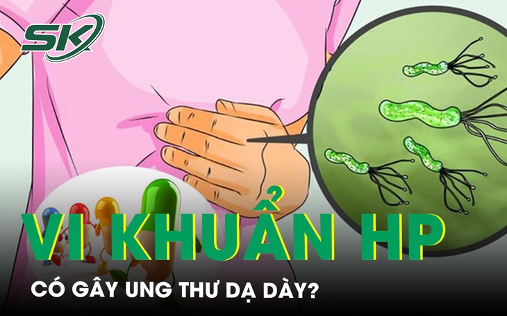 Việt Nam thuộc nhóm có tỷ lệ nhiễm HP cao trên thế giới, nhiều người tái nhiễm vì bỏ quên một "ổ chứa" vi khuẩn- Ảnh 5.