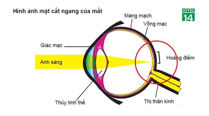 Thoái hóa hoàng điểm tuổi già - đừng bỏ quên đôi mắt mẹ cha- Ảnh 2.