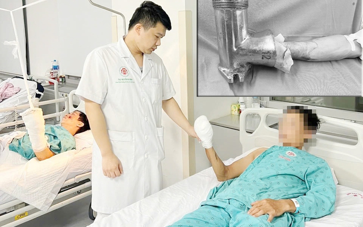 "Hồi sinh" bàn tay cho bệnh nhân bị dập nát do máy xay thịt