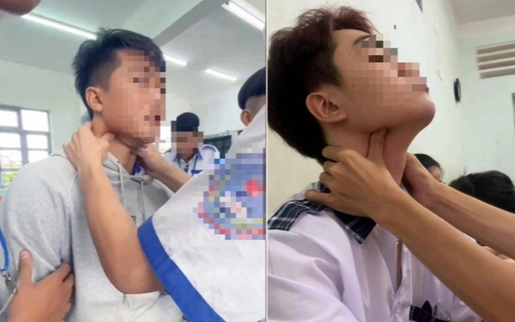 CDC Hà Nội cảnh báo trào lưu "bắt pen" ở giới trẻ