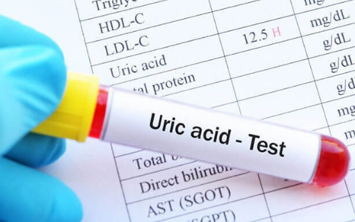 Ai có nguy cơ bị tăng acid uric máu?