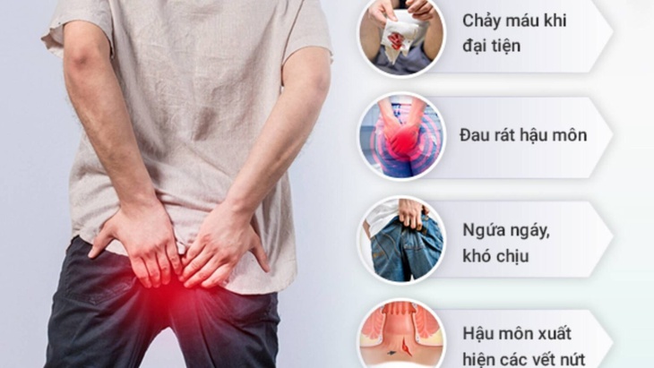 Nứt kẽ hậu môn: Nguyên nhân, triệu chứng, cách điều trị và phòng bệnh- Ảnh 1. Nứt kẽ hậu môn: Nguyên nhân, triệu chứng, cách điều trị và phòng bệnh- Ảnh 1.