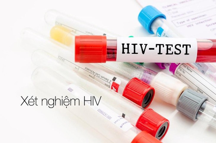 Nhiều giải pháp hiệu quả trong phòng, chống HIV ở Khánh Hòa- Ảnh 2. Nhiều giải pháp hiệu quả trong phòng, chống HIV ở Khánh Hòa- Ảnh 2.