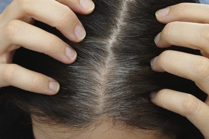 Nguyên nhân khiến tóc bạc sớm và cách khắc phục- Ảnh 1.