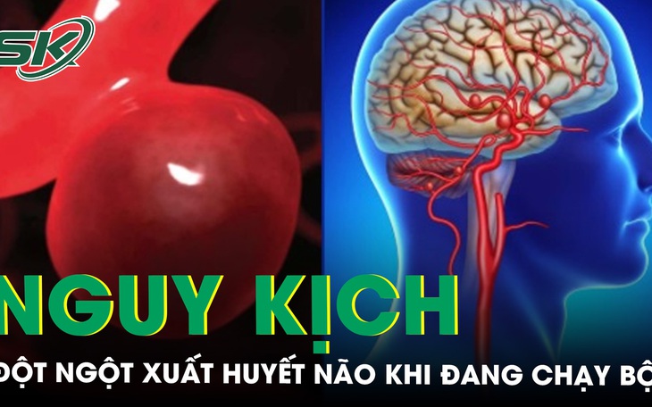 Bé trai nguy kịch vì xuất huyết não khi đang chạy bộ trong trường 