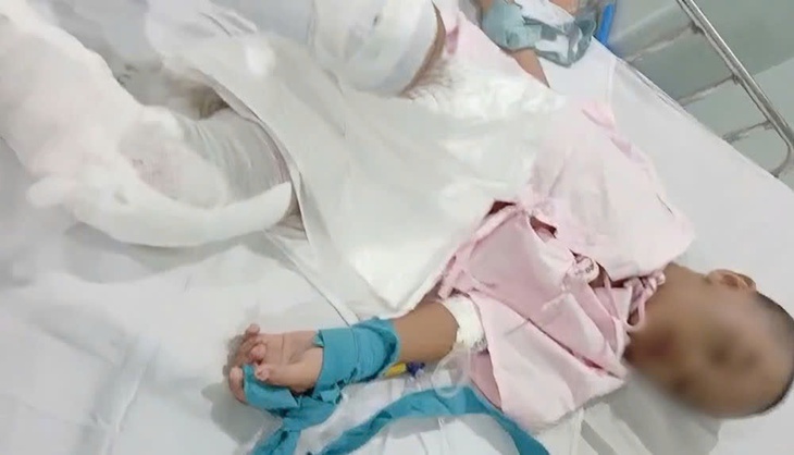 Bé trai 6 tuổi ở TPHCM nghi bị cha tạt nước sôi lên chân- Ảnh 1. Bé trai 6 tuổi ở TPHCM nghi bị cha tạt nước sôi lên chân- Ảnh 1.