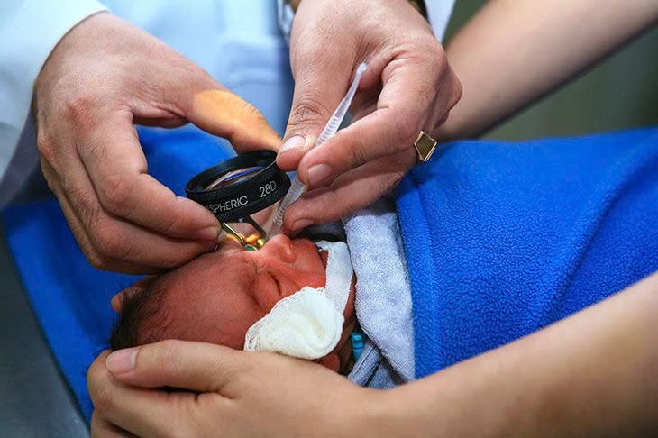 Bệnh võng mạc: Nguyên nhân, triệu chứng, phòng bệnh và cách điều trị- Ảnh 9. Bệnh võng mạc: Nguyên nhân, triệu chứng, phòng bệnh và cách điều trị- Ảnh 9.