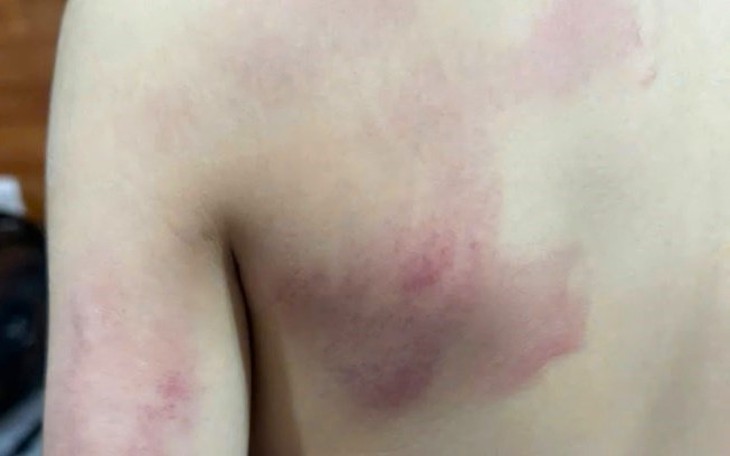 Giáo viên đánh học sinh, vì đâu nên nỗi?