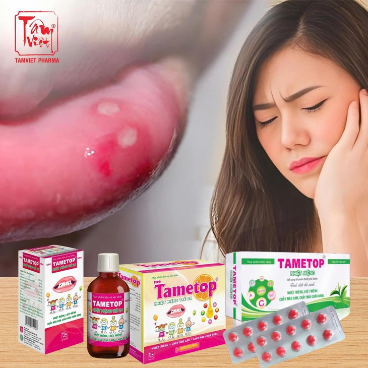 Bí quyết từ thảo dược hỗ trợ giảm nỗi lo nhiệt miệng dai dẳng mùa lạnh- Ảnh 1.