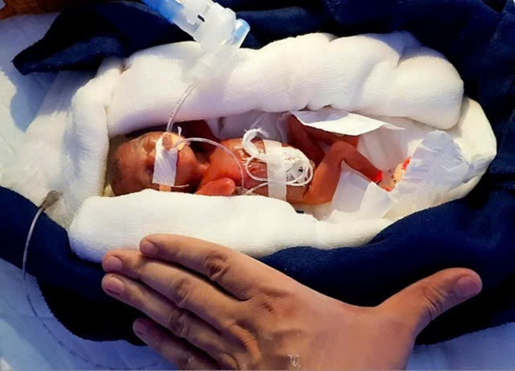 Bệnh viêm màng ối: Nguyên nhân, triệu chứng, phòng bệnh và cách điều trị- Ảnh 3. Bệnh viêm màng ối: Nguyên nhân, triệu chứng, phòng bệnh và cách điều trị- Ảnh 3.