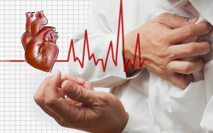 Câu hỏi thường gặp về bệnh nhịp tim chậm