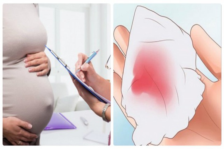 Thai chết lưu: Nguyên nhân, triệu chứng, chẩn đoán và điều trị- Ảnh 1.