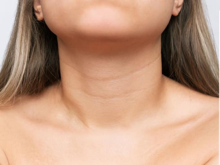 Làm thế nào để giảm nếp nhăn ở cổ?- Ảnh 1.