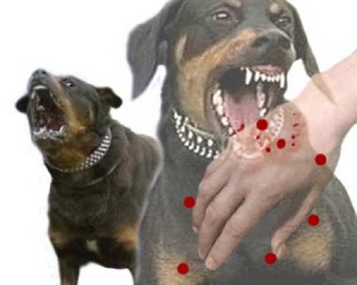 Một người tử vong sau gần 2 tháng bị chó cắn- Ảnh 1.