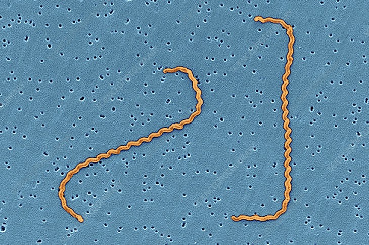 Nhiễm xoắn khuẩn Leptospira có biểu hiện như thế nào?- Ảnh 1. Nhiễm xoắn khuẩn Leptospira có biểu hiện như thế nào?- Ảnh 1.