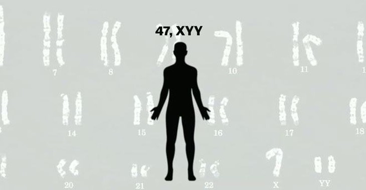 Bài tập cho người mắc hội chứng XYY- Ảnh 1.