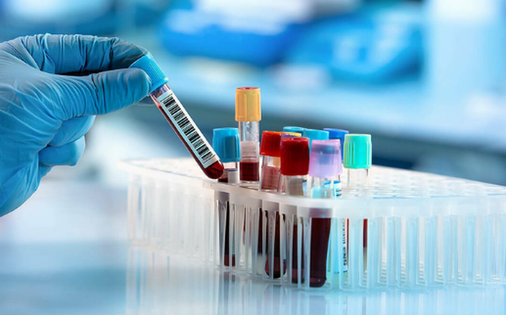Vai trò của xét nghiệm tế bào CD4 với người nhiễm HIV- Ảnh 1.