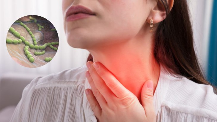 Viêm họng cấp có thể gây ra biến chứng gì?- Ảnh 1.