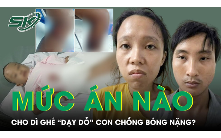 Sáng 7/10: Dì ghẻ "dạy dỗ" con chồng bỏng nặng có thể đối mặt với tội danh cố ý gây thương tích?