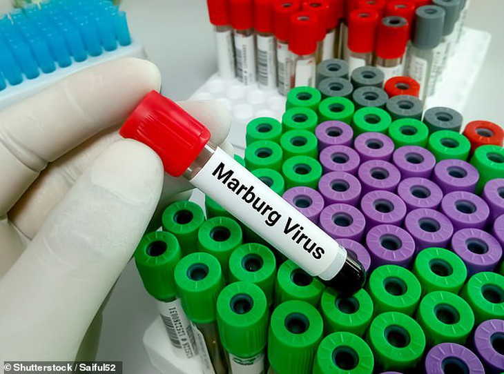 Rwanda triển khai thử nghiệm vaccine Marburg- Ảnh 1. Rwanda triển khai thử nghiệm vaccine Marburg- Ảnh 1.