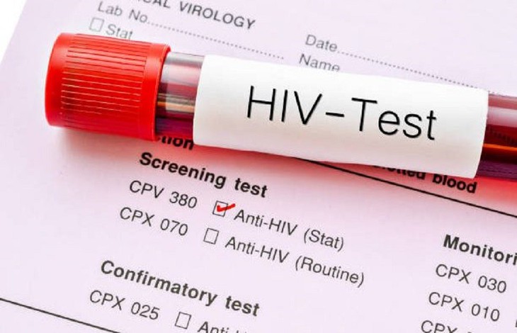 Người nhiễm HIV ở Khánh Hòa hiểu về bệnh để an tâm điều trị- Ảnh 2. Người nhiễm HIV ở Khánh Hòa hiểu về bệnh để an tâm điều trị- Ảnh 2.