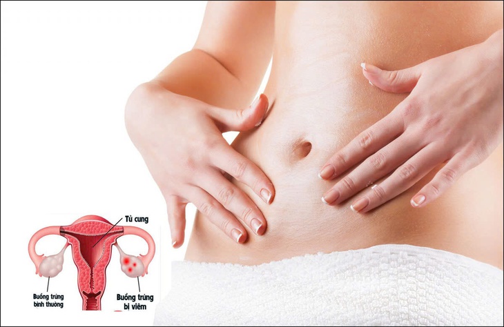 Các loại thuốc điều trị bệnh viêm ống dẫn trứng- Ảnh 5. Các loại thuốc điều trị bệnh viêm ống dẫn trứng- Ảnh 5.
