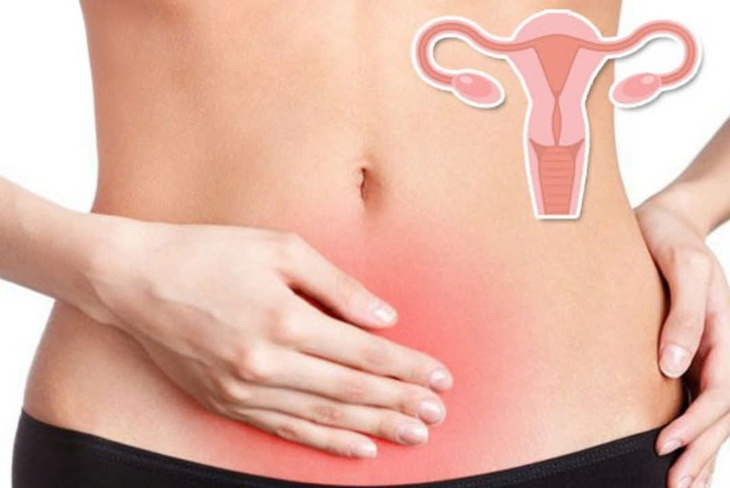 Bệnh vô kinh: Nguyên nhân, triệu chứng, phòng bệnh và cách điều trị- Ảnh 5.