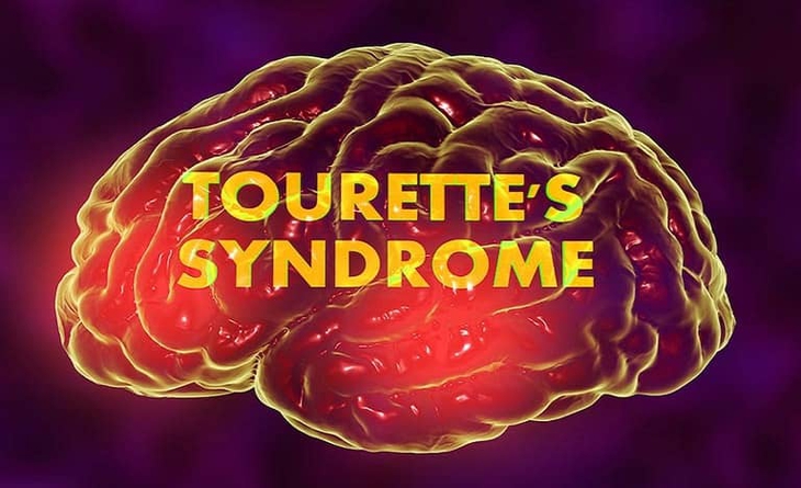 Các biện pháp điều trị hội chứng Tourette- Ảnh 1.