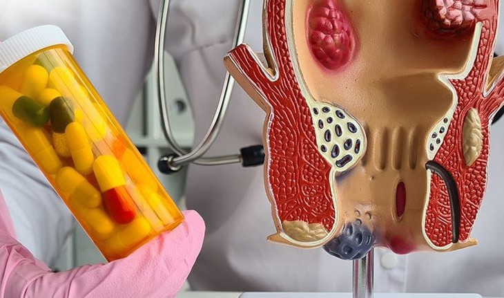 Câu hỏi thường gặp liên quan đến hẹp hậu môn ở trẻ em- Ảnh 1.