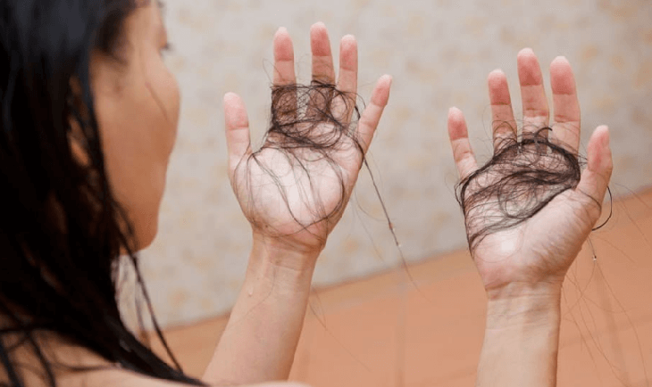 Rụng tóc nhiều bất thường do nguyên nhân gì và cách khắc phục- Ảnh 1.