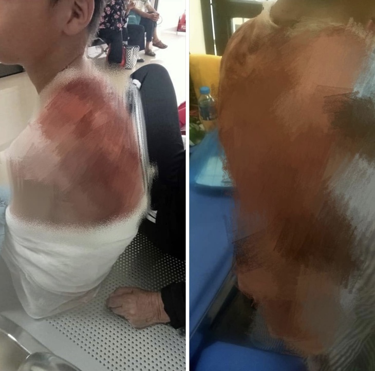 Vĩnh Phúc: Chính quyền địa phương đang xác minh nghi vấn mẹ kế dội nước sôi lên người con riêng của chồng- Ảnh 1. Vĩnh Phúc: Chính quyền địa phương đang xác minh nghi vấn mẹ kế dội nước sôi lên người con riêng của chồng- Ảnh 1.