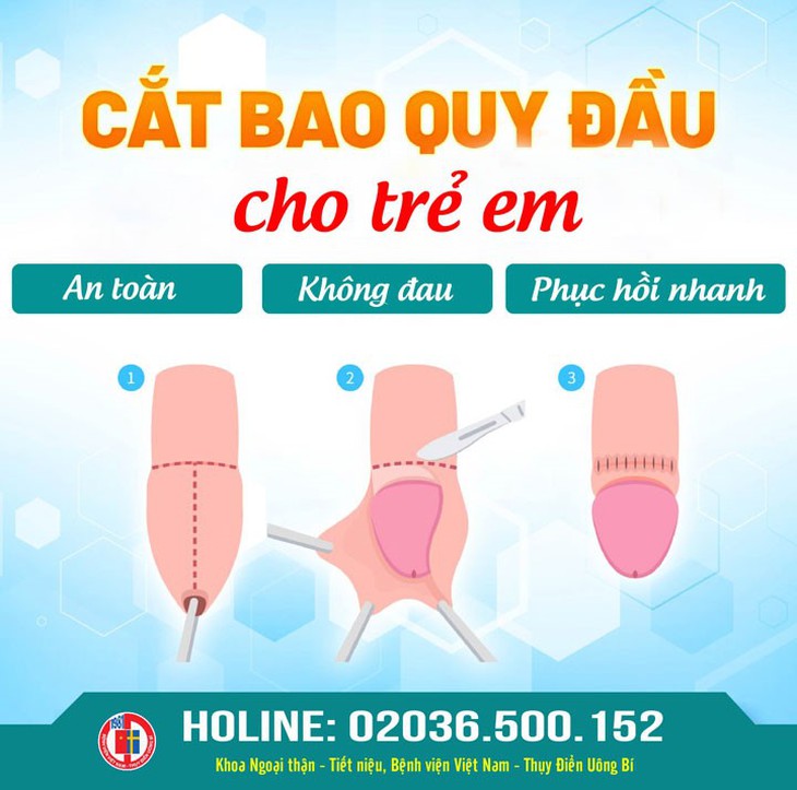 Trẻ phải nhập viện do tự lộn bao quy đầu- Ảnh 1. Trẻ phải nhập viện do tự lộn bao quy đầu- Ảnh 1.