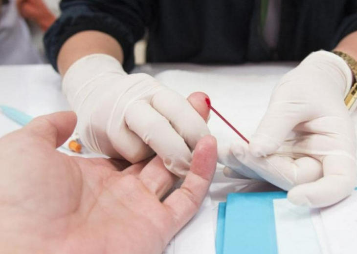 Đẩy mạnh xét nghiệm HIV, tăng cường tiếp cận với dịch vụ hướng tới kết thúc dịch bệnh AIDS- Ảnh 2.