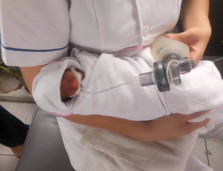 Mỗi năm có hơn 100 nghìn trẻ sinh non, Bộ Y tế đẩy mạnh truyền thông giảm thiểu rủi ro- Ảnh 3. Mỗi năm có hơn 100 nghìn trẻ sinh non, Bộ Y tế đẩy mạnh truyền thông giảm thiểu rủi ro- Ảnh 3.
