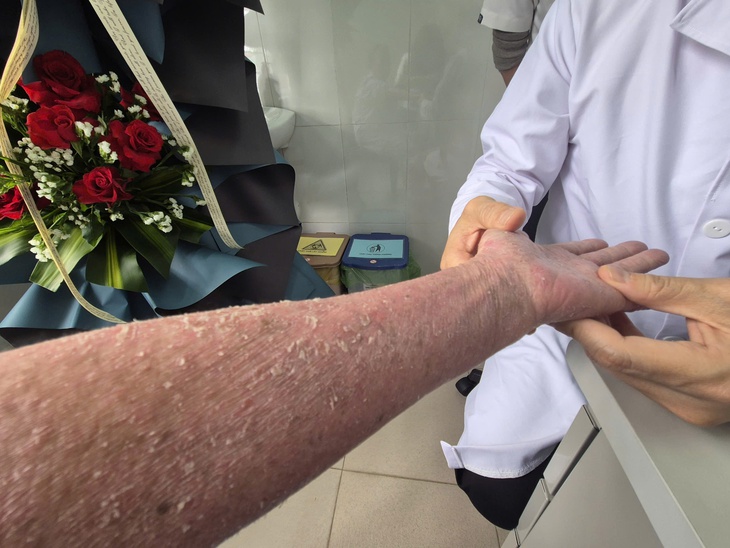 Bệnh nhân vảy nến ở Huế được quản lý toàn diện, tiếp cận thuốc mới- Ảnh 7.
