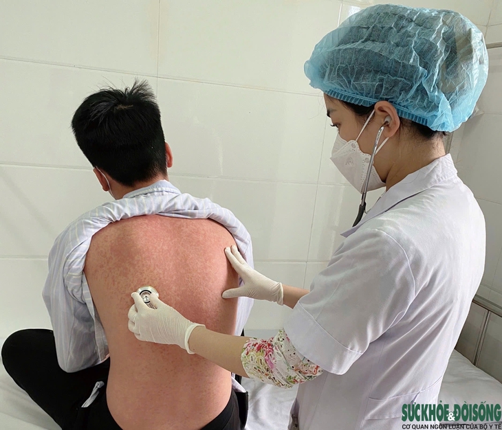 Người lớn chủ quan với bệnh sởi dễ gặp nhiều biến chứng- Ảnh 1.