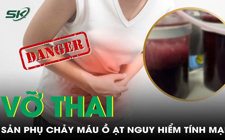 Cứu sống sản phụ sốc mất máu do vỡ thai góc sừng tử cung ở tuần 21 - Ảnh 2.