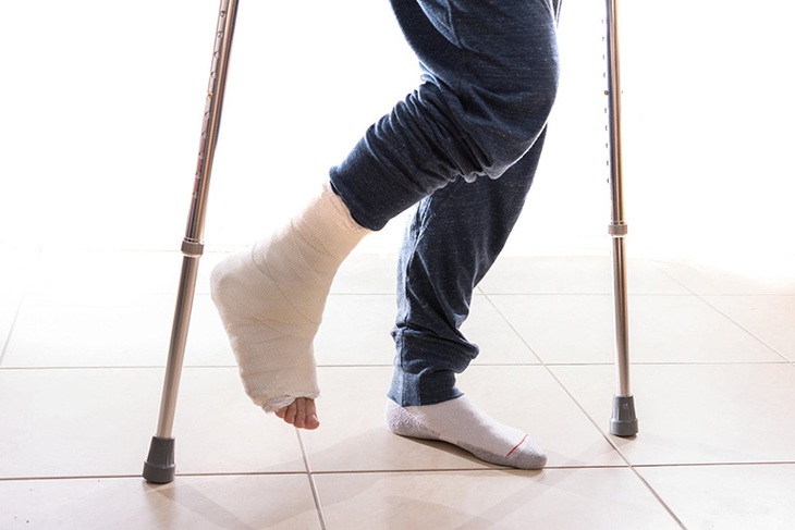 5 câu hỏi thường gặp cho người bị gãy xương- Ảnh 3. 5 câu hỏi thường gặp cho người bị gãy xương- Ảnh 3.