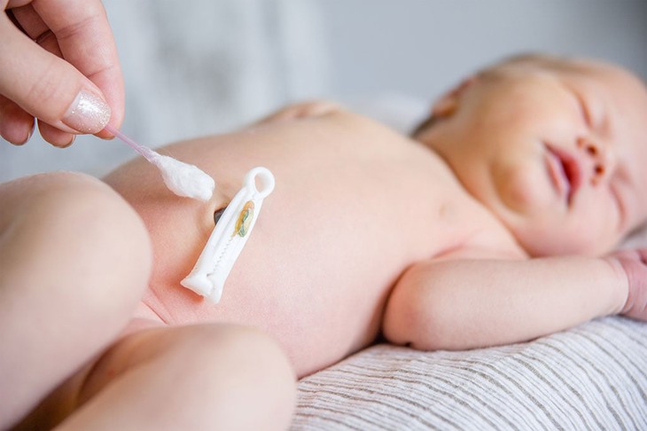 Chăm sóc rốn cho trẻ sơ sinh đúng chuẩn, an toàn | Huggies
