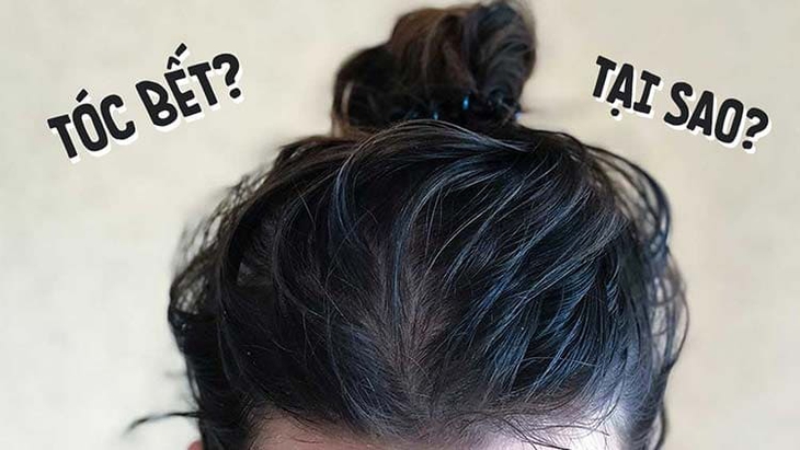Mẹo khắc phục tóc bết trong mùa đông- Ảnh 1.