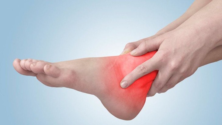 Khô khớp cổ chân có biểu hiện như thế nào?- Ảnh 1. Khô khớp cổ chân có biểu hiện như thế nào?- Ảnh 1.